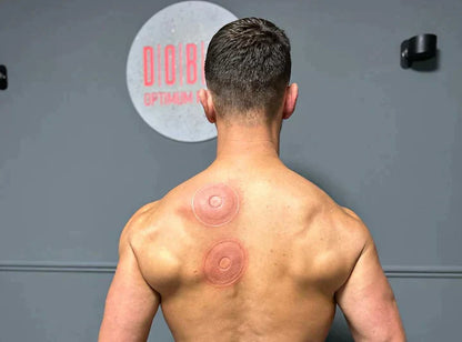 Voltify SmartCup – 3-in-1 Cupping Therapy, Red Light & Heat Massage Device