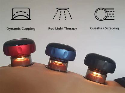 Voltify SmartCup – 3-in-1 Cupping Therapy, Red Light & Heat Massage Device